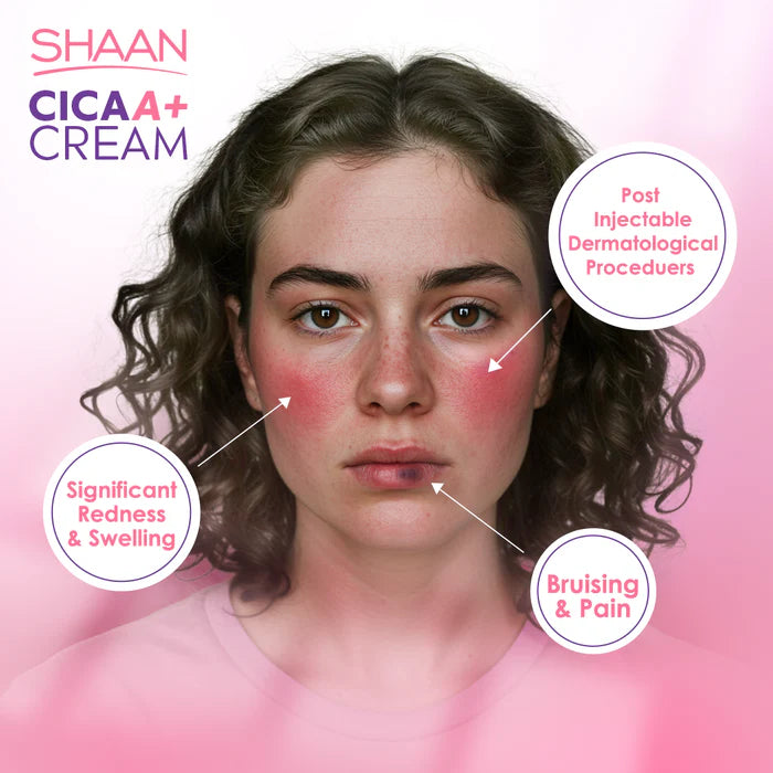 SHAAN CICA A+ Cream 40gm