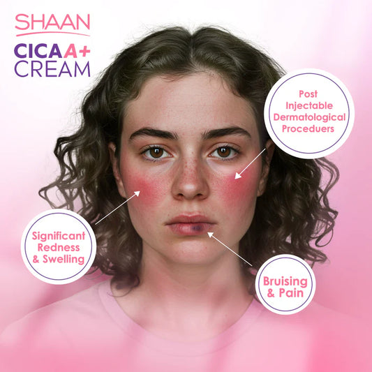 SHAAN CICA A+ Cream 40gm